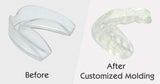 CABS - 2 Piece Mouth Guard Set - Stop Bruxism